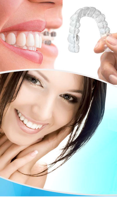 Invisalign braces from dentist in Rotherham